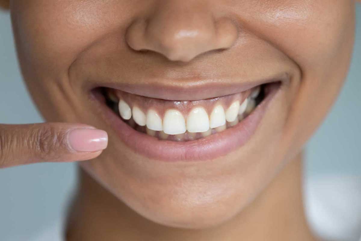 Align Your Smile: Tips for Choosing the Best Orthodontic Treatment
