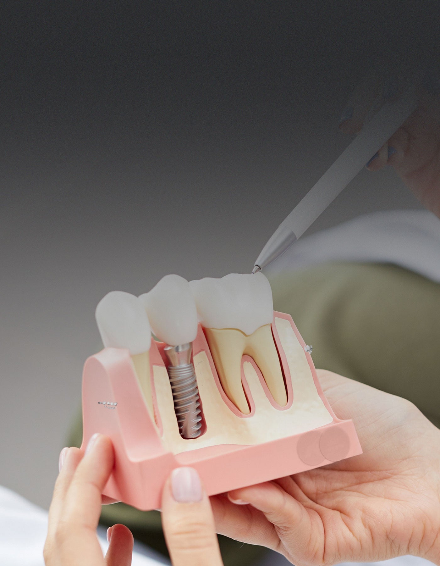 Specialist holding model of a dental implant
